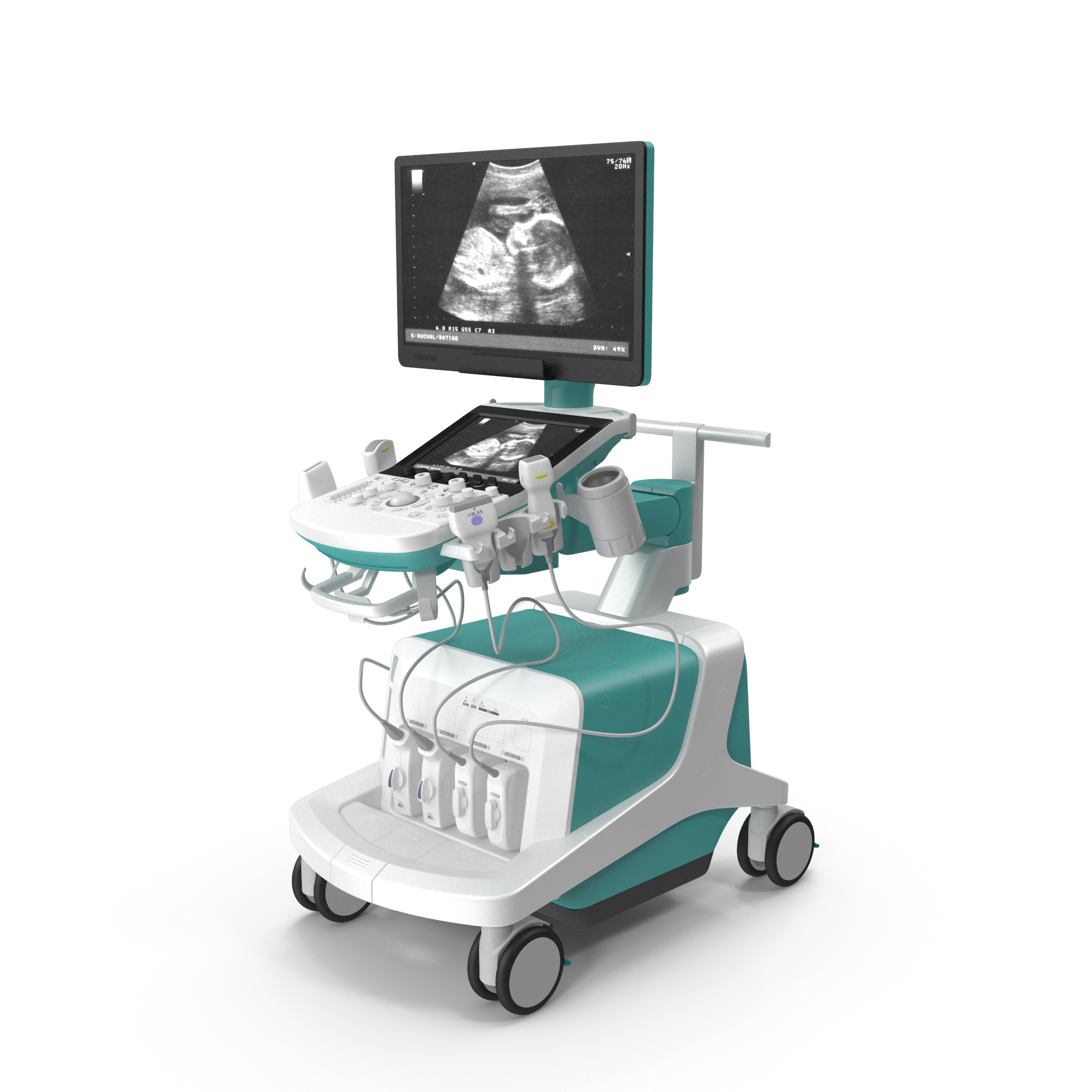 Ultrasound Scanner System Generic.H03.2k